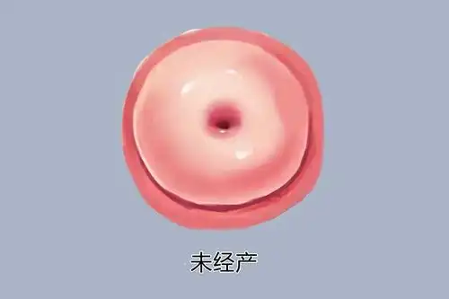 宫颈高清放大图片