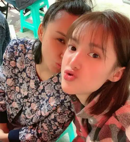 明星产后脱发,生孩子发际线对比杨幂还好,张歆艺胡杏儿很夸张