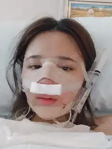 悦美美女千千万,我的闺蜜占一半开玩笑,表打我今天...隆鼻悦美整形