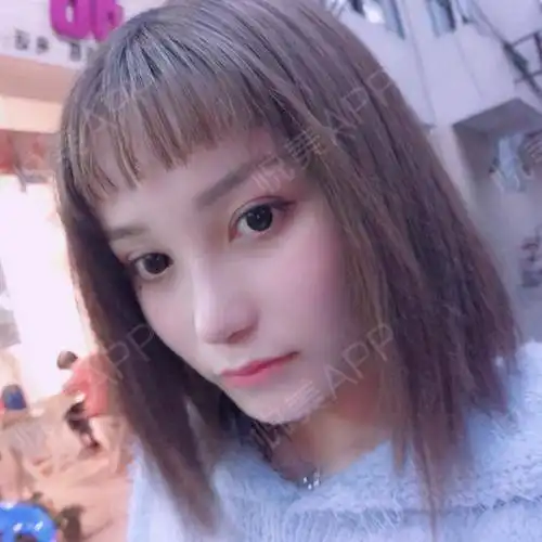 适合自己的才是最好的,医生就是根据我的五官来设计的...垫鼻尖悦美整形
